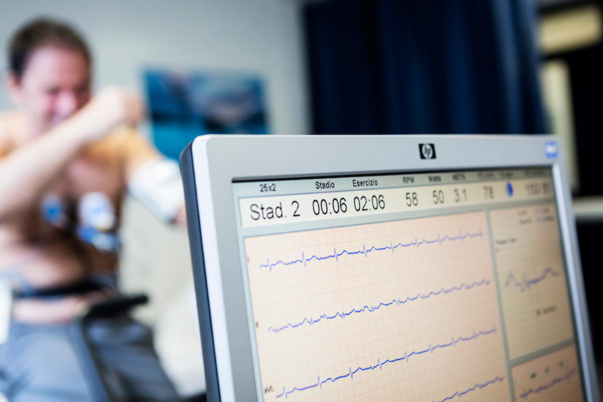 Monitor raffigurante un elettrocardiogramma